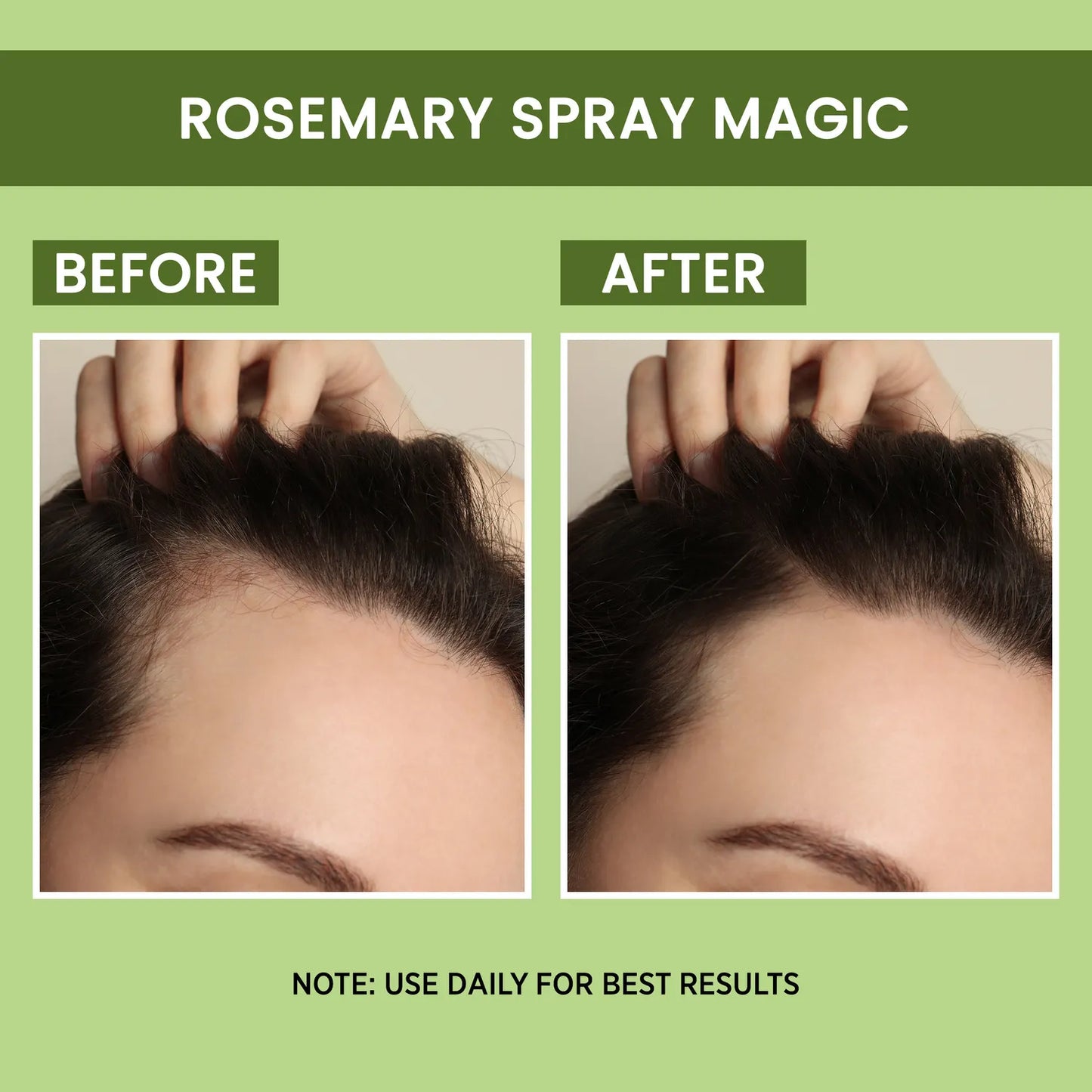 Alps Goodness Hair Regrowth Spray (Buy 1 Get 1 Free)