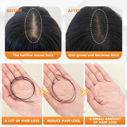 Natural Anti-Hair Fall Treatment Shampoo (Buy 1 Get 1 Free)