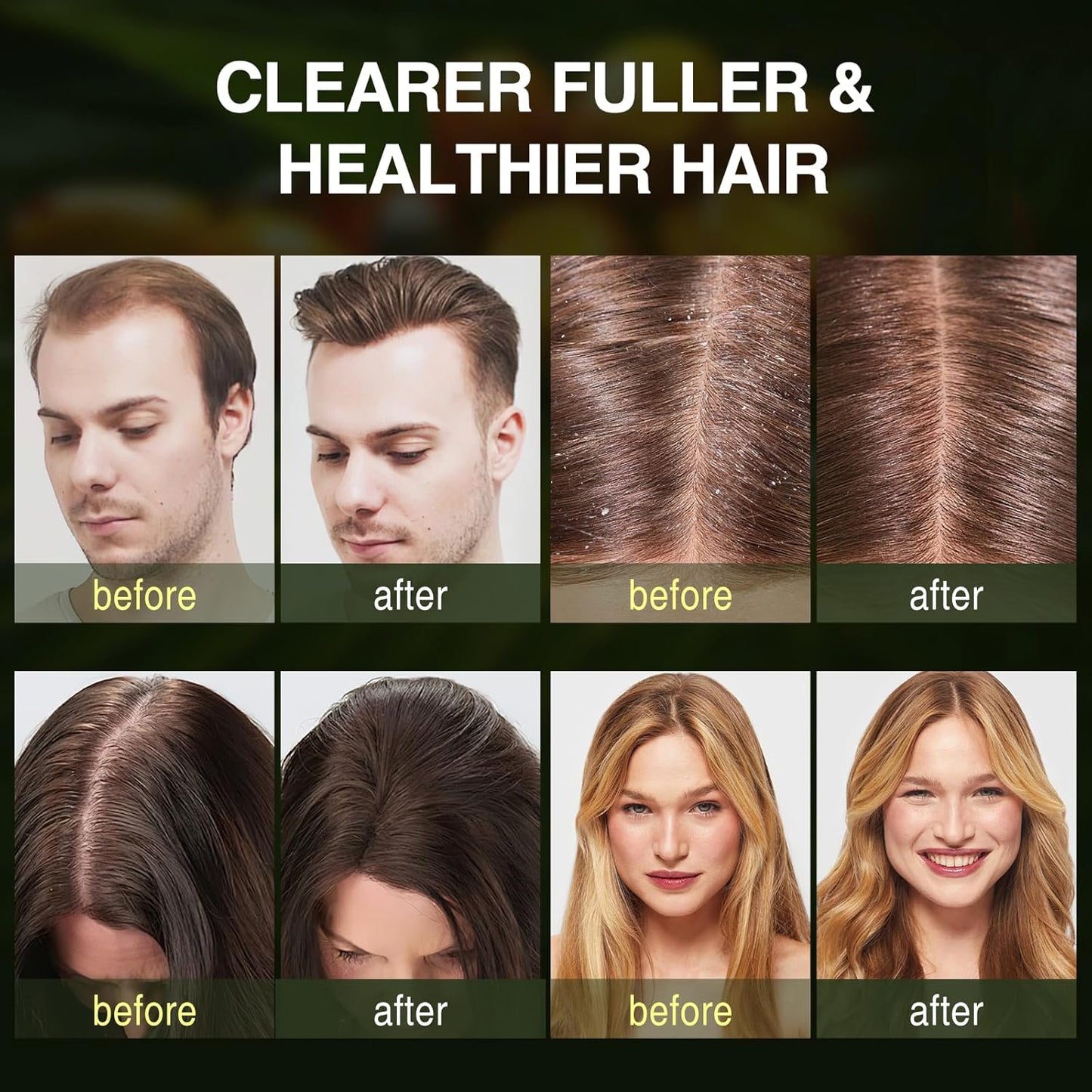 Buiti 3-in-1 Natural Anti Hair Fall Shampoo (Buy 1 Get 1 Free)