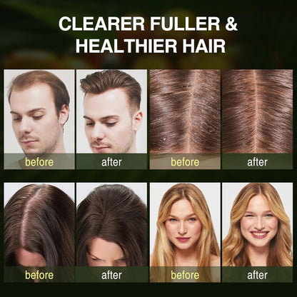 Buiti 3-in-1 Natural Anti Hair Fall Shampoo (Buy 1 Get 1 Free)