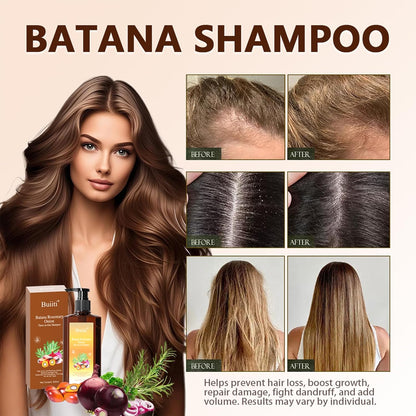 Buiti 3-in-1 Natural Anti Hair Fall Shampoo (Buy 1 Get 1 Free)