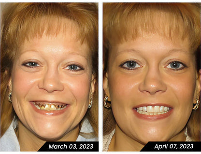Bamboo Activated Charcoal™ Teeth Whitening Toothpaste