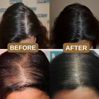 Natural Anti-Hair Fall Treatment Shampoo (Buy 1 Get 1 Free)