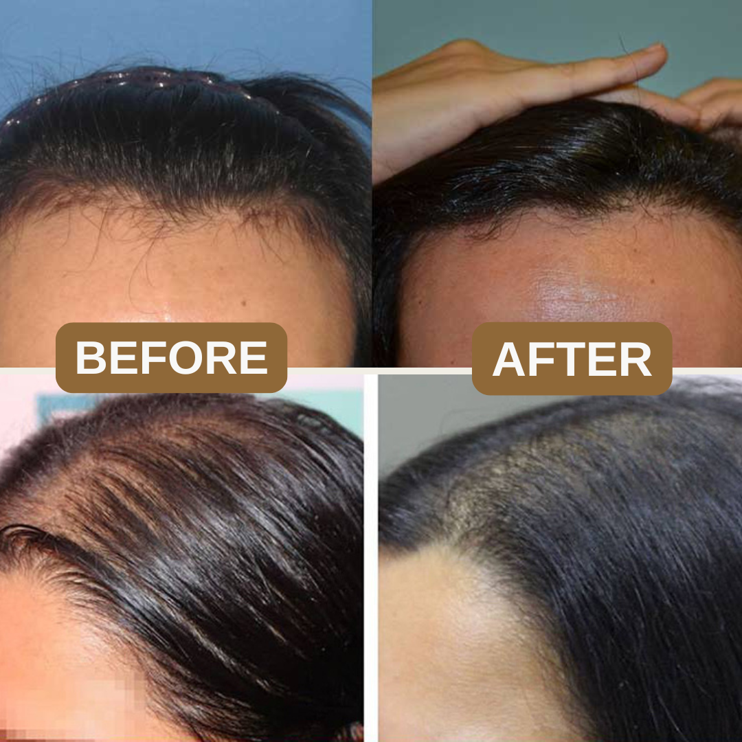 Buiti 3-in-1 Natural Anti Hair Fall Shampoo (Buy 1 Get 1 Free)