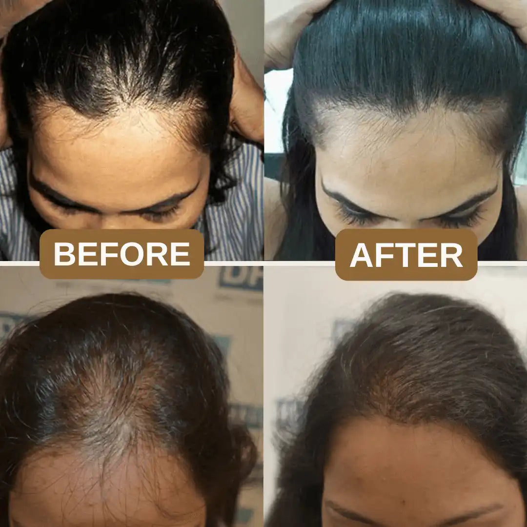 Rosemary Keratin Boost Hair Growth Shampoo (Buy 1 Get 1 Free)