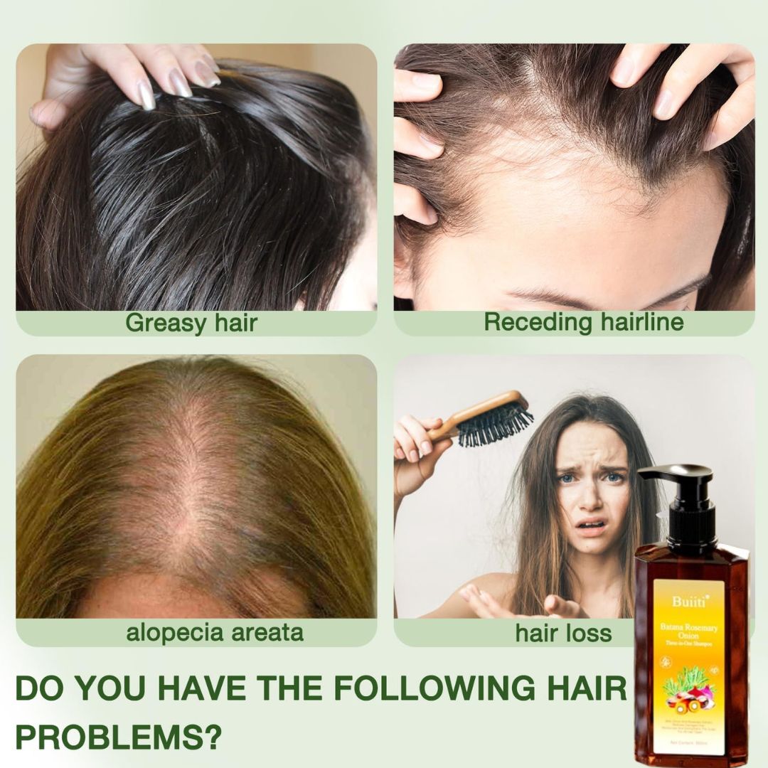 Buiti 3-in-1 Natural Anti Hair Fall Shampoo (Buy 1 Get 1 Free)