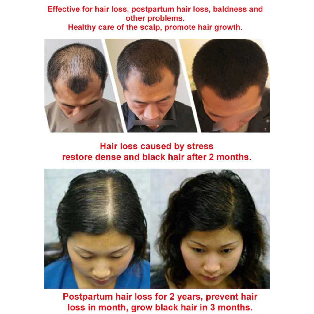 Natural Anti-Hair Fall Treatment Shampoo (Buy 1 Get 1 Free)