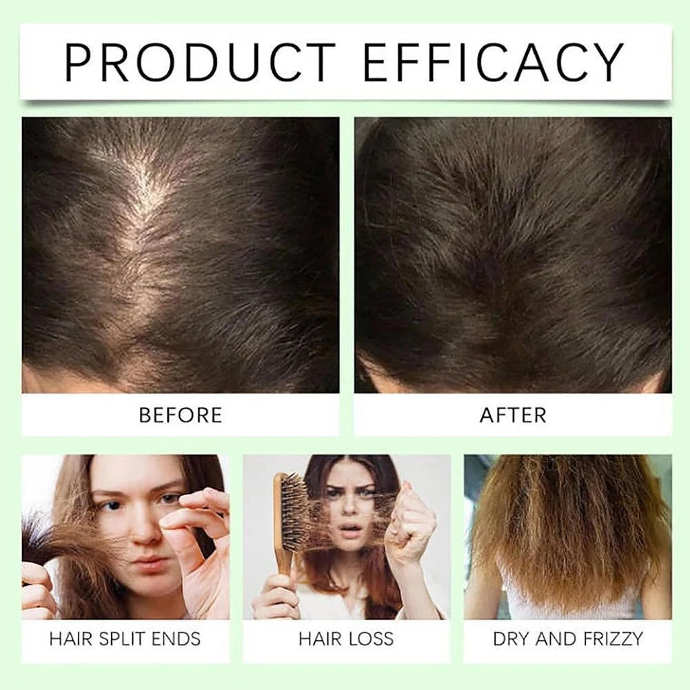 Natural Anti-Hair Fall Treatment Shampoo (Buy 1 Get 1 Free)