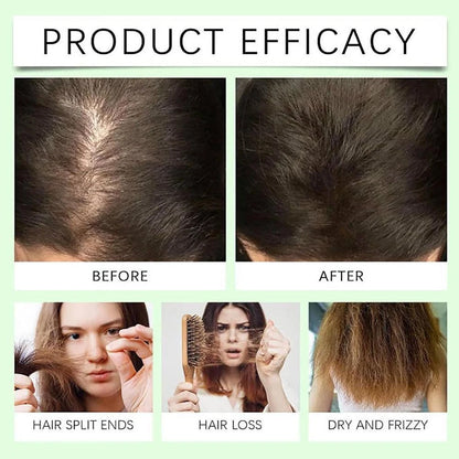 Natural Anti-Hair Fall Treatment Shampoo (Buy 1 Get 1 Free)